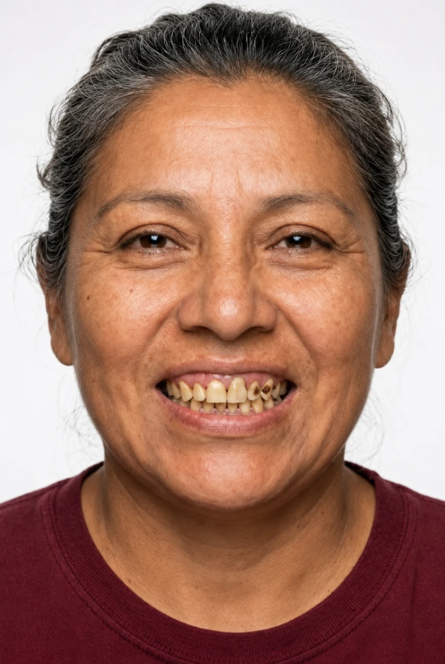 Before treatment